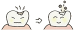 虫歯治療
